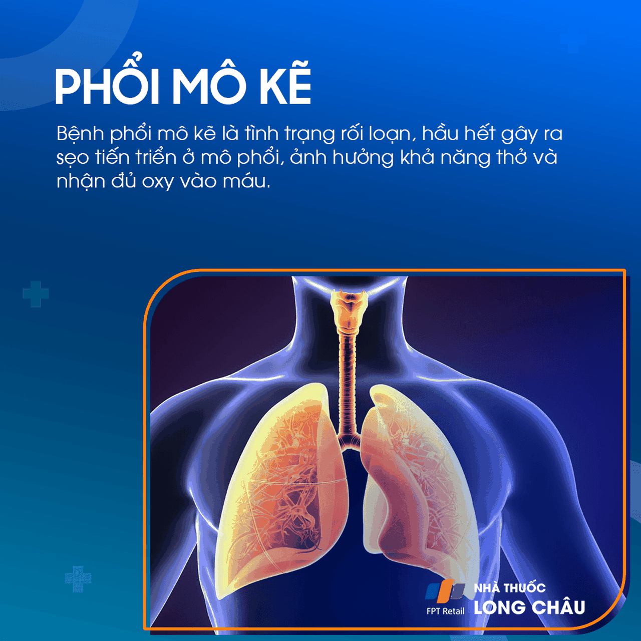 Phổi mô kẽ 1