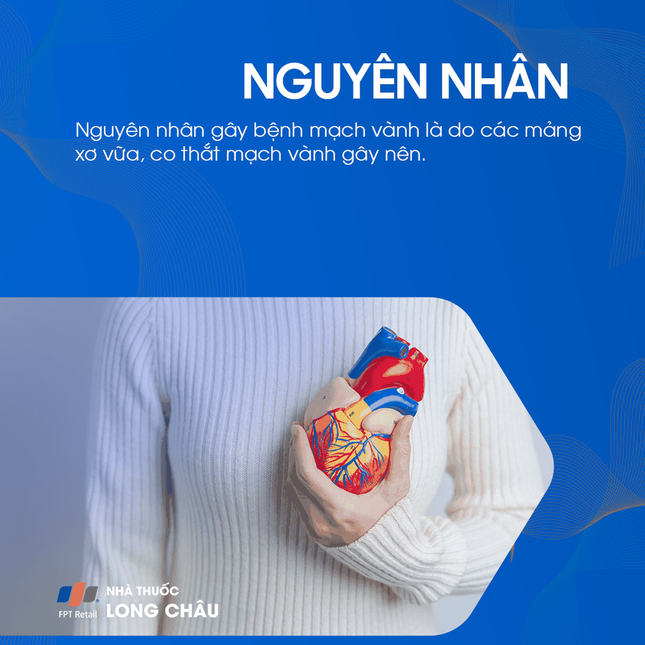 Động mạch bị xơ vữa và co thắt là nguyên nhân gây bệnh mạch vành