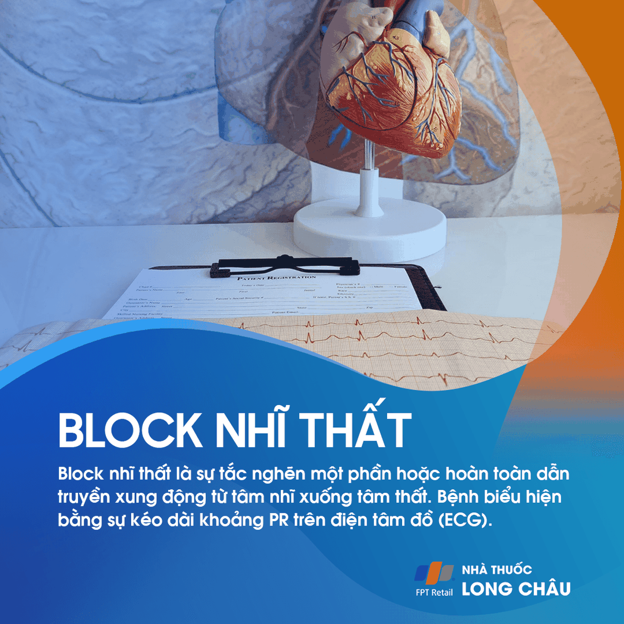 Block nhĩ thất 1