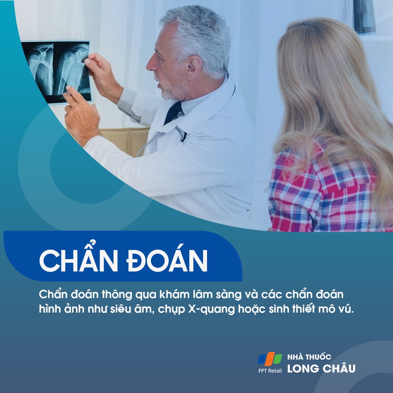 Bướu sợi tuyến 5