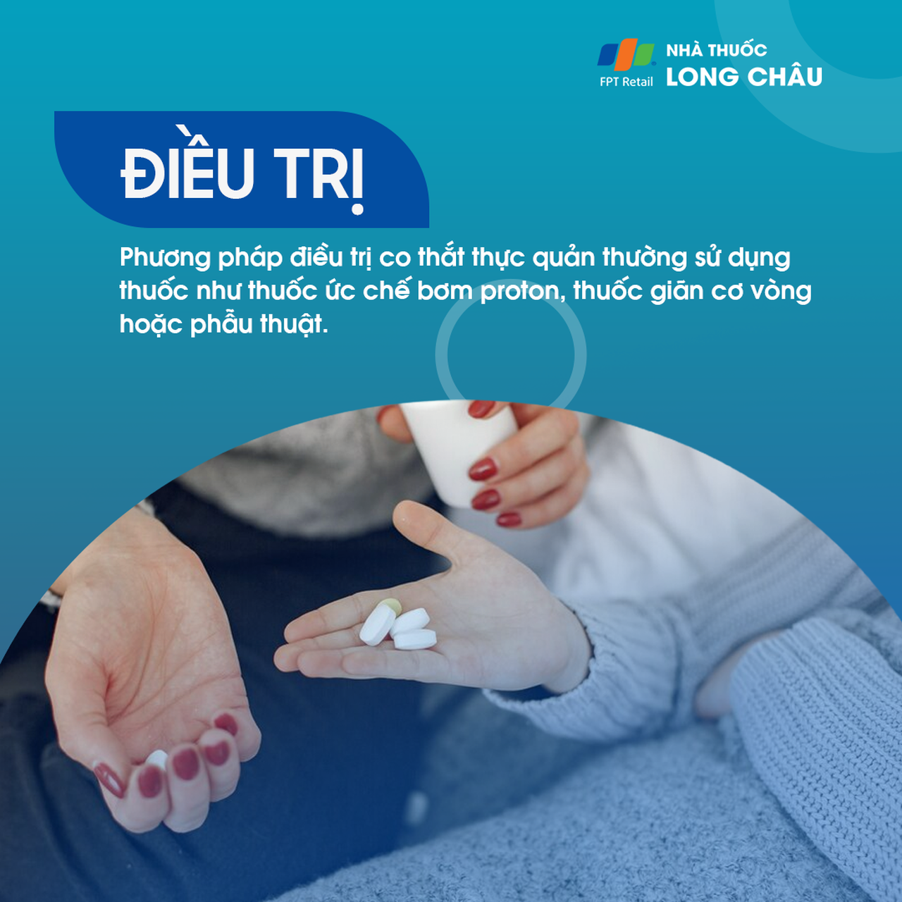 Co thắt thực quản 6