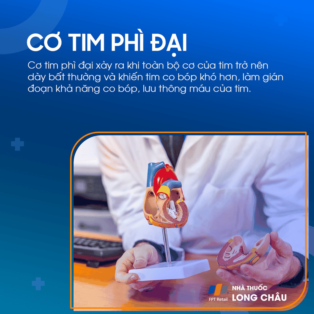 Cơ tim phì đại 1