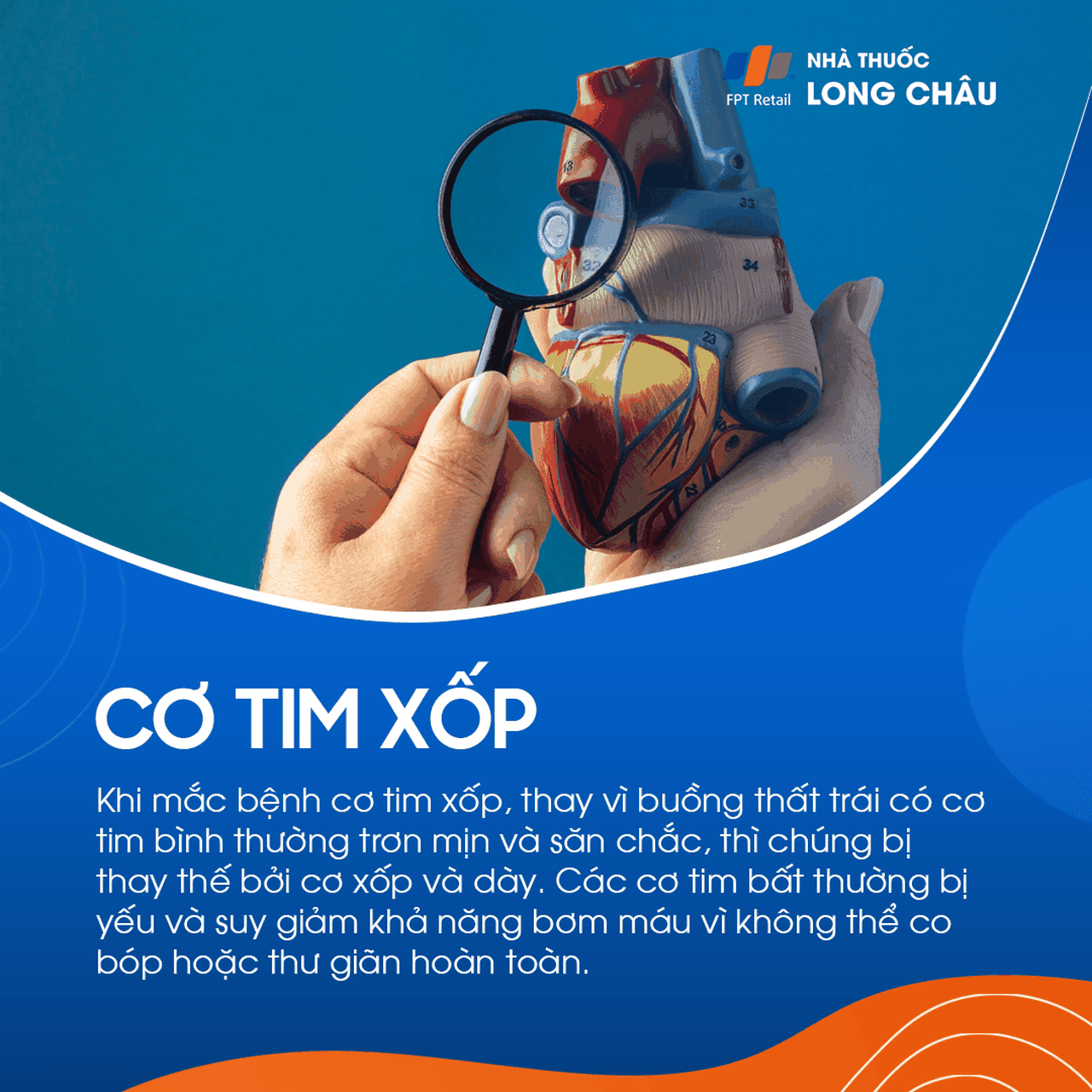 Cơ tim xốp 1
