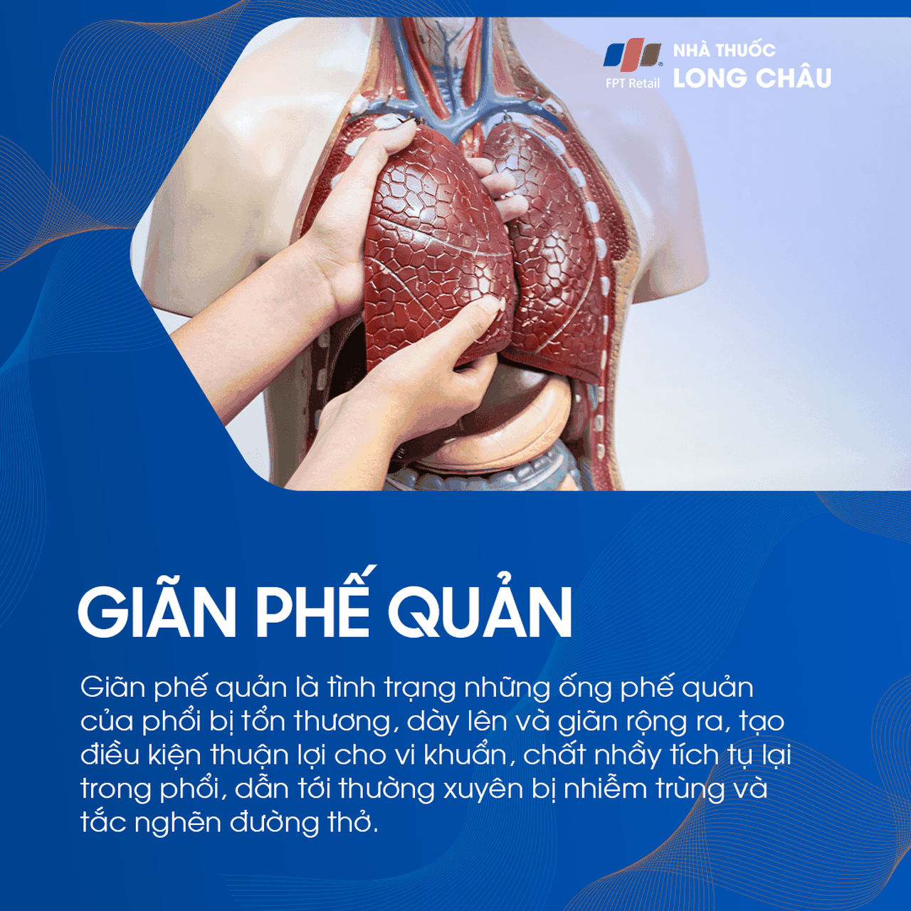 Giãn phế quản 1