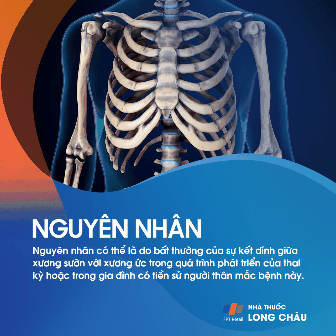 Ngực lỡm bẩm sinh 3