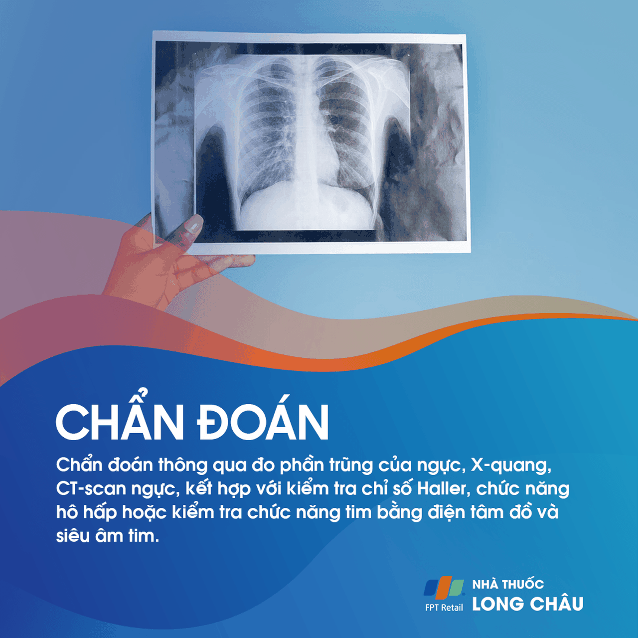 Ngực lỡm bẩm sinh 5