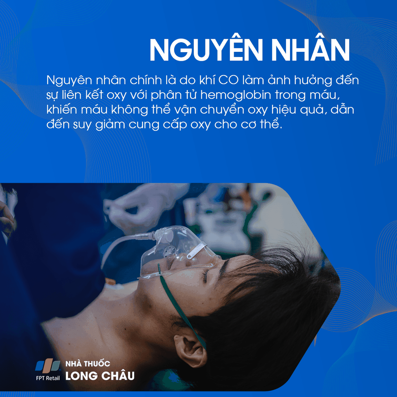 Ngộ độc Carbon Monoxide 3