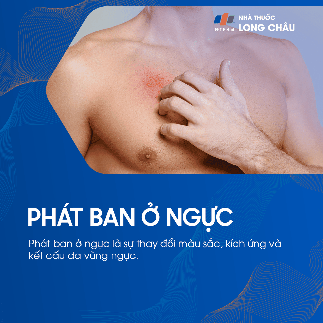 Phát ban ở ngực 1