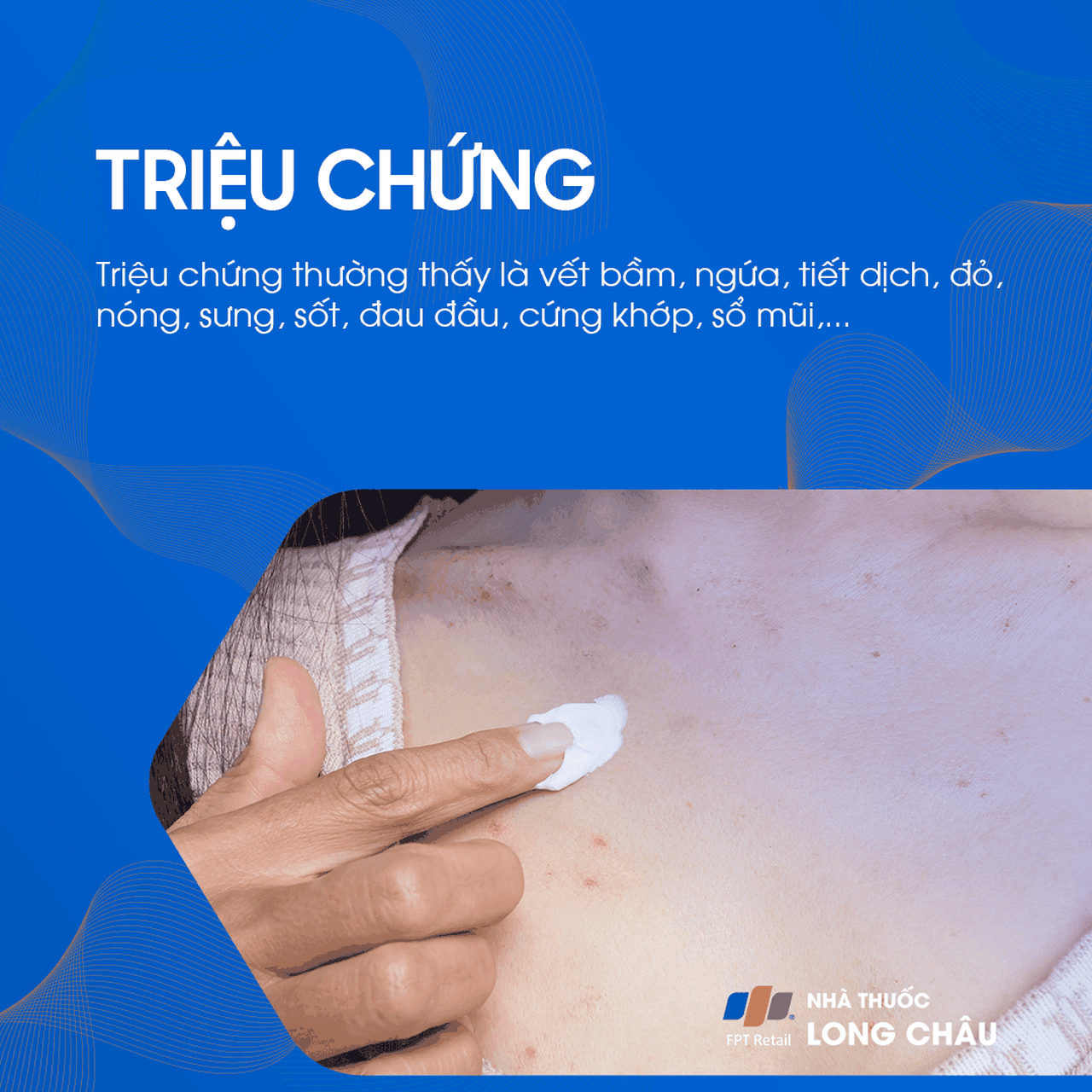 Phát ban ở ngực 2