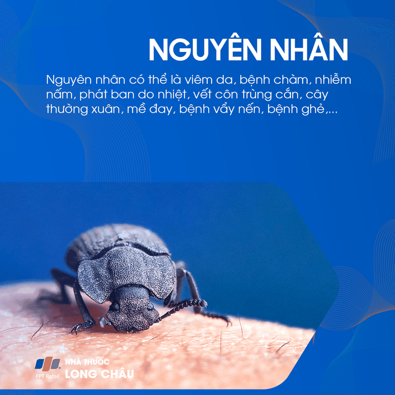 Phát ban ở ngực 3