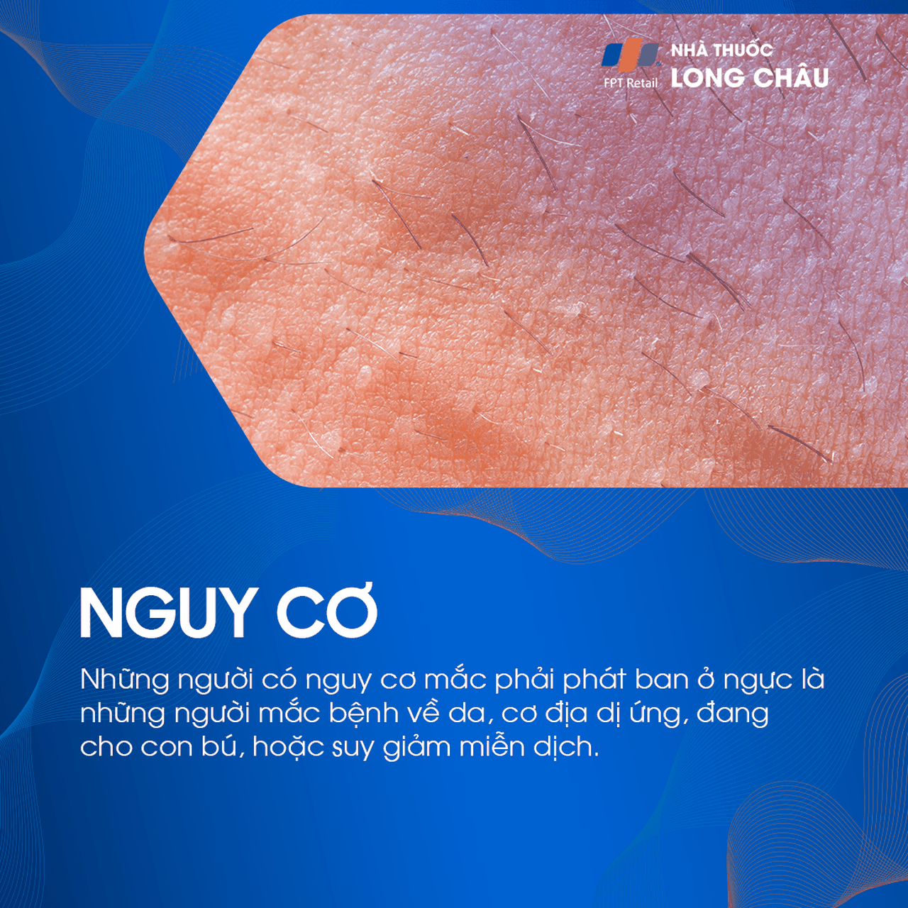 Phát ban ở ngực 4