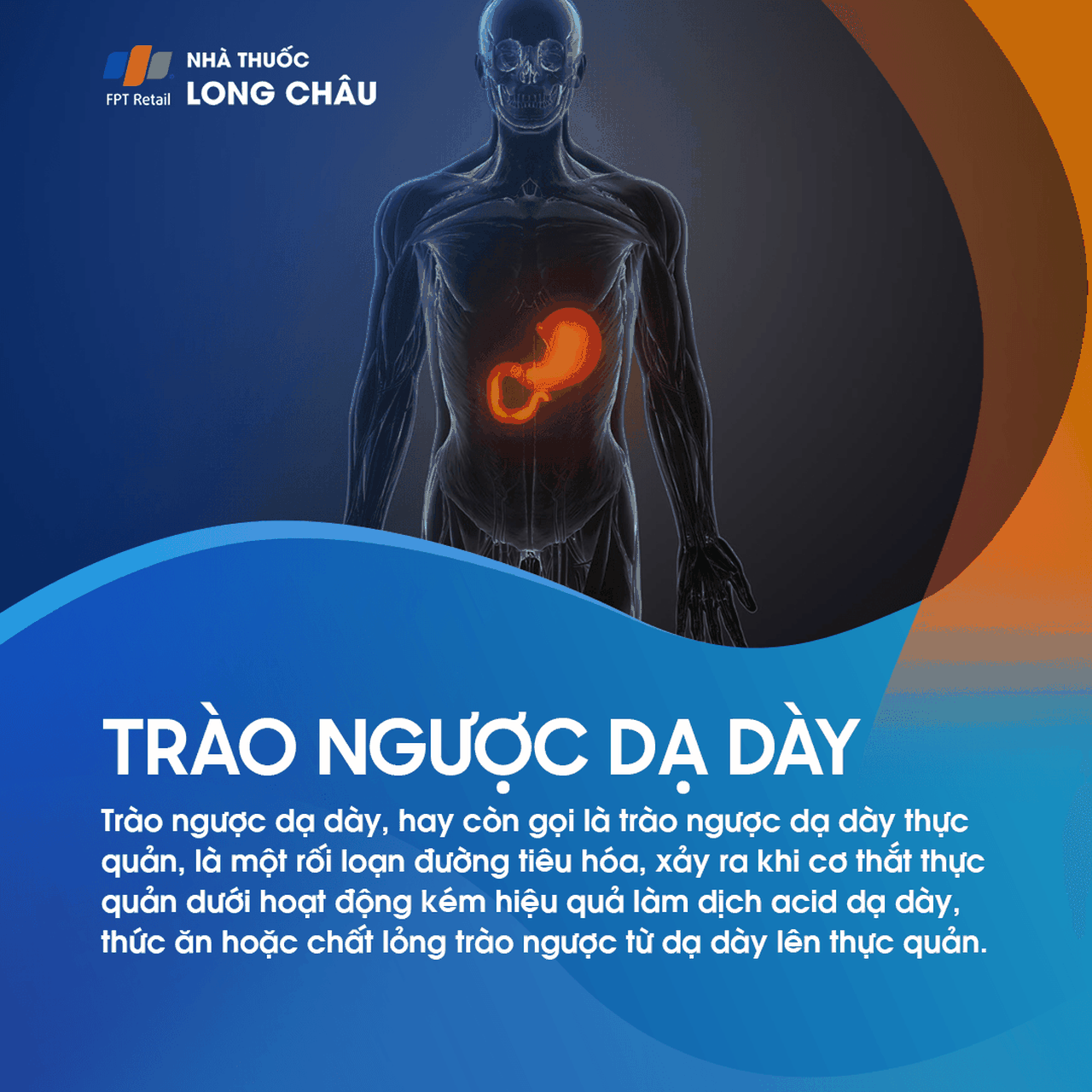 Bệnh trào ngược dạ dày thực quản là gì