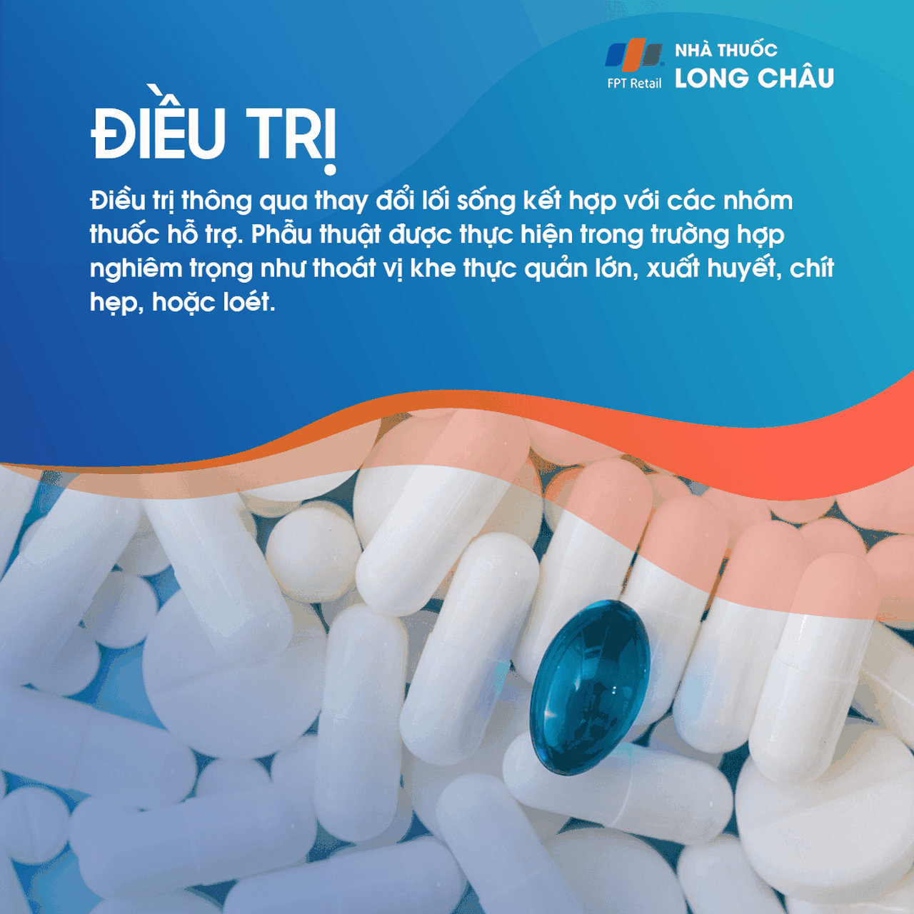 Điều trị trào ngược dạ dày bằng thuốc và thay đổi lối sống