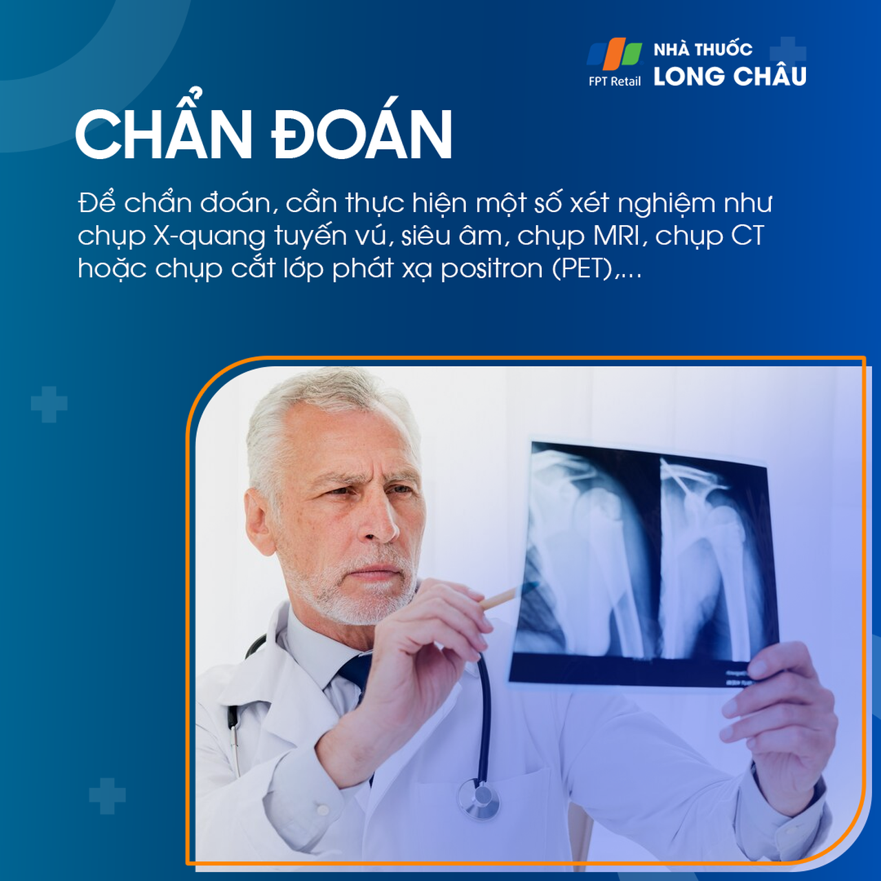 Ung thư vú tái phát 5