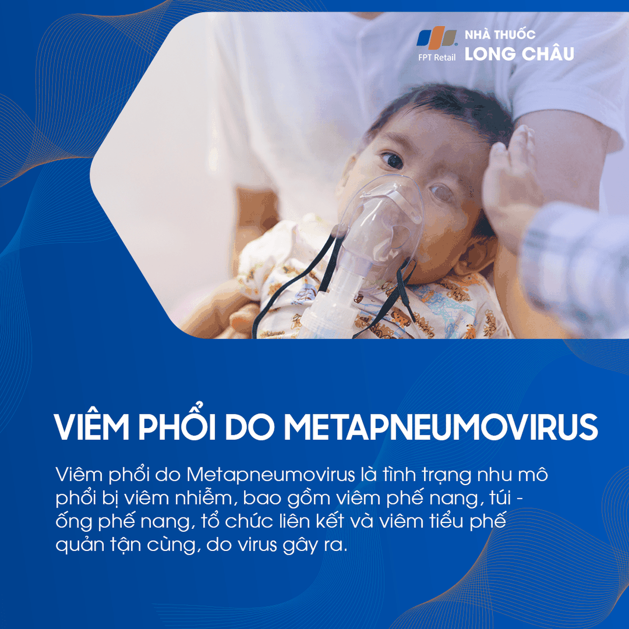 Viêm phổi do Metapneumovirus 1