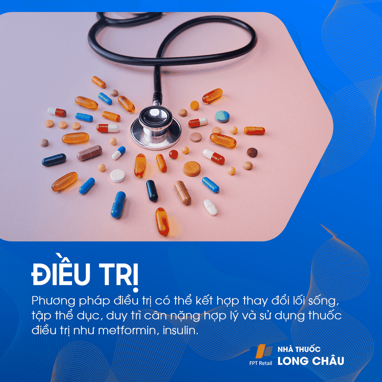 Bệnh nhân tiểu đường tuýp 2 đang uống thuốc hạ đường huyết theo hướng dẫn của bác sĩ, một phần của phác đồ điều trị