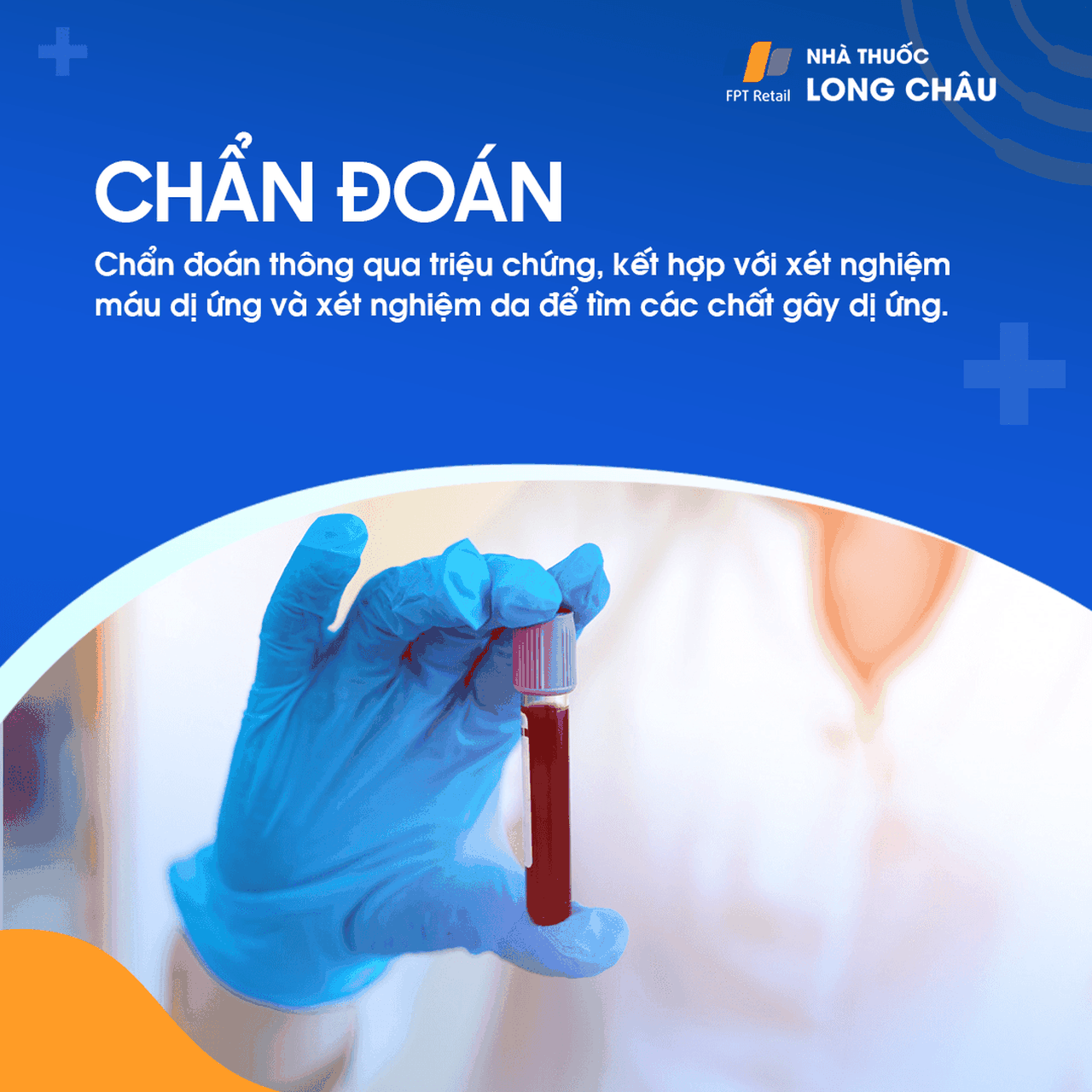 Chẩn đoán dị ứng dựa trên triệu chứng, xét nghiệm máu và xét nghiệm da