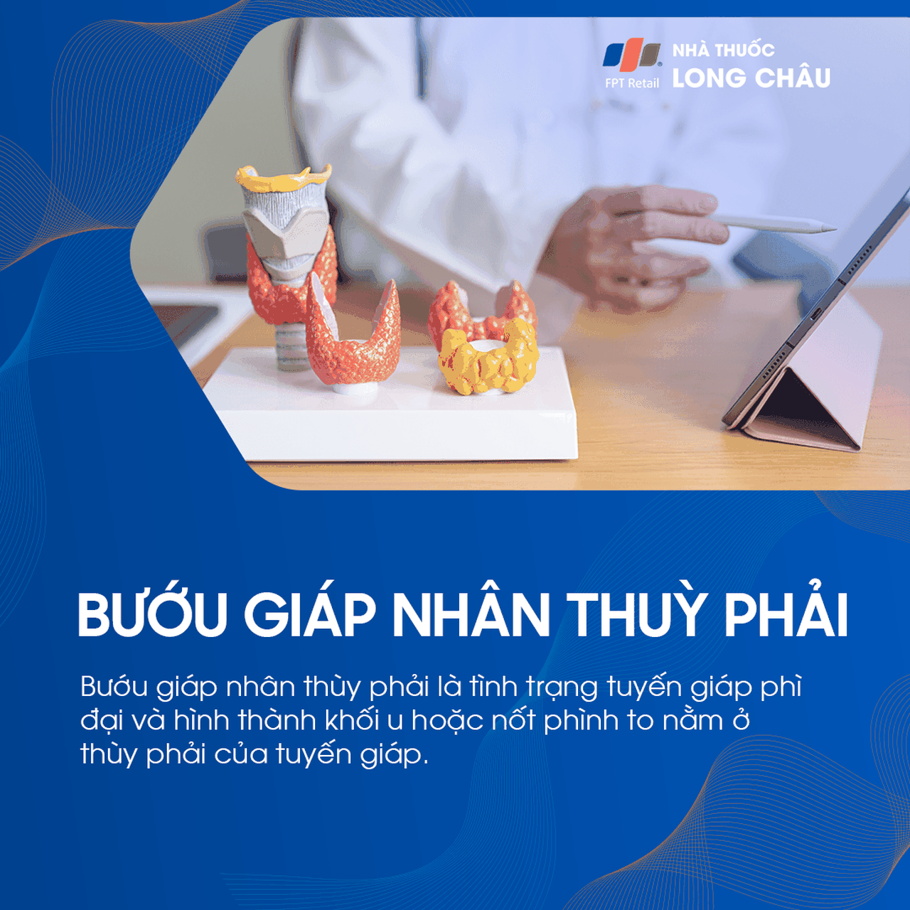 Bướu giáp nhân thùy phải 1