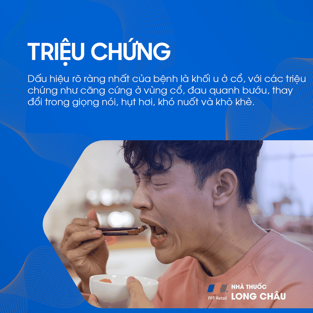 Bướu giáp nhân thùy phải 2