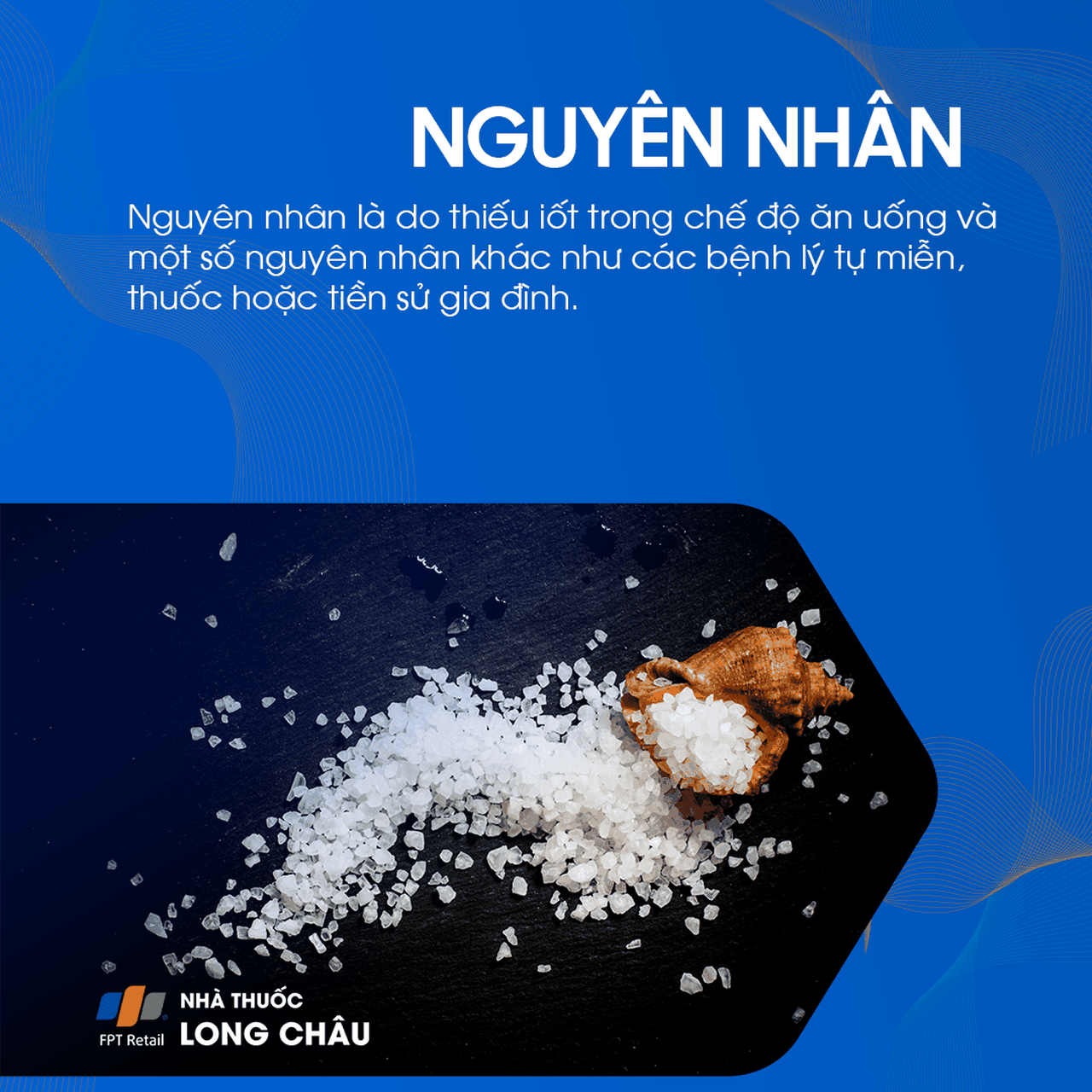 Bướu giáp nhân thùy phải 3