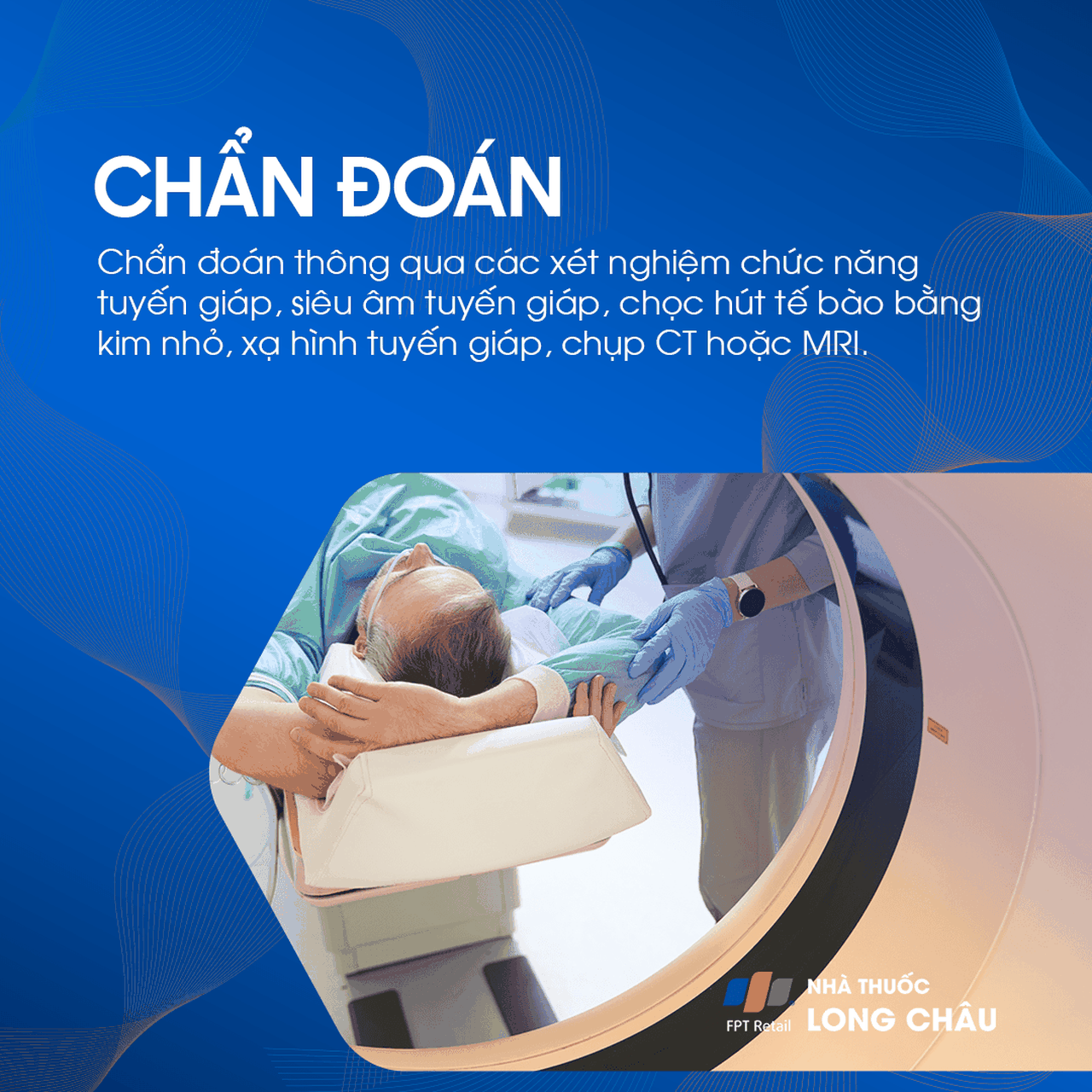Bướu giáp nhân thùy phải 5