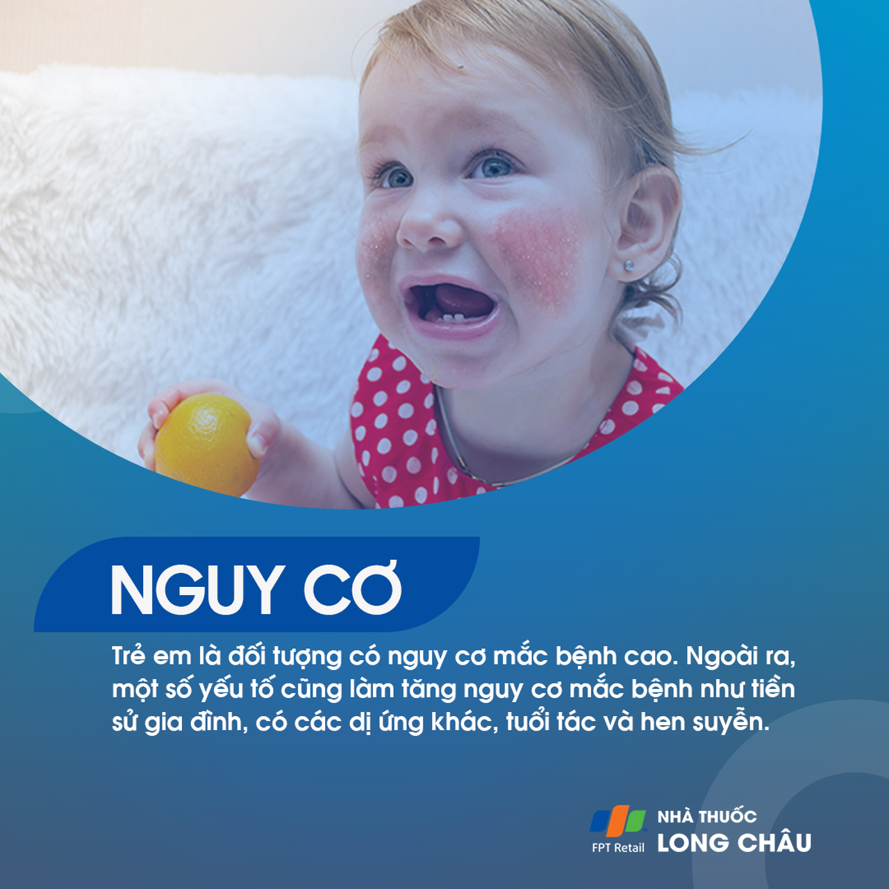 Dị ứng thực phẩm 7