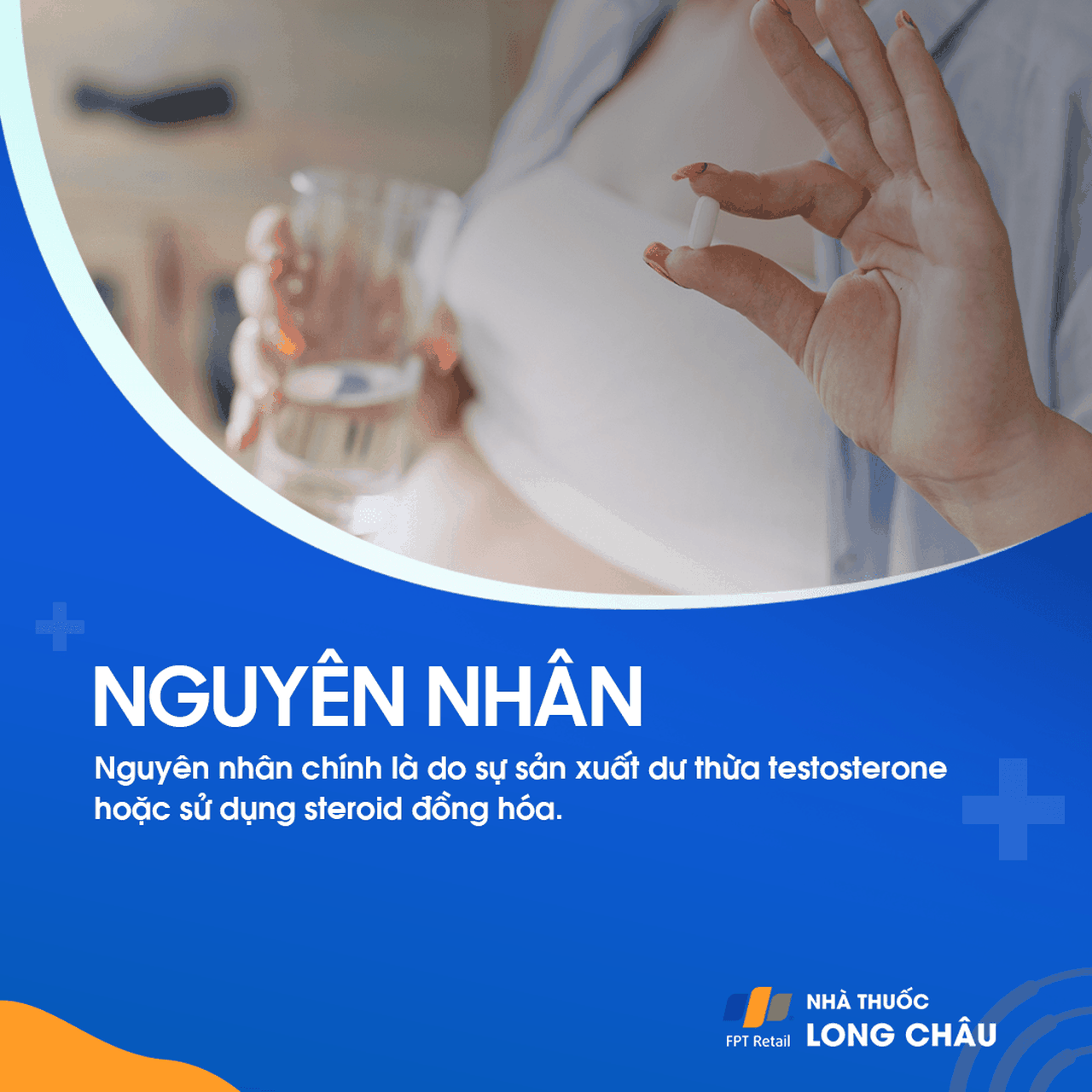 Hội chứng nam hóa 4