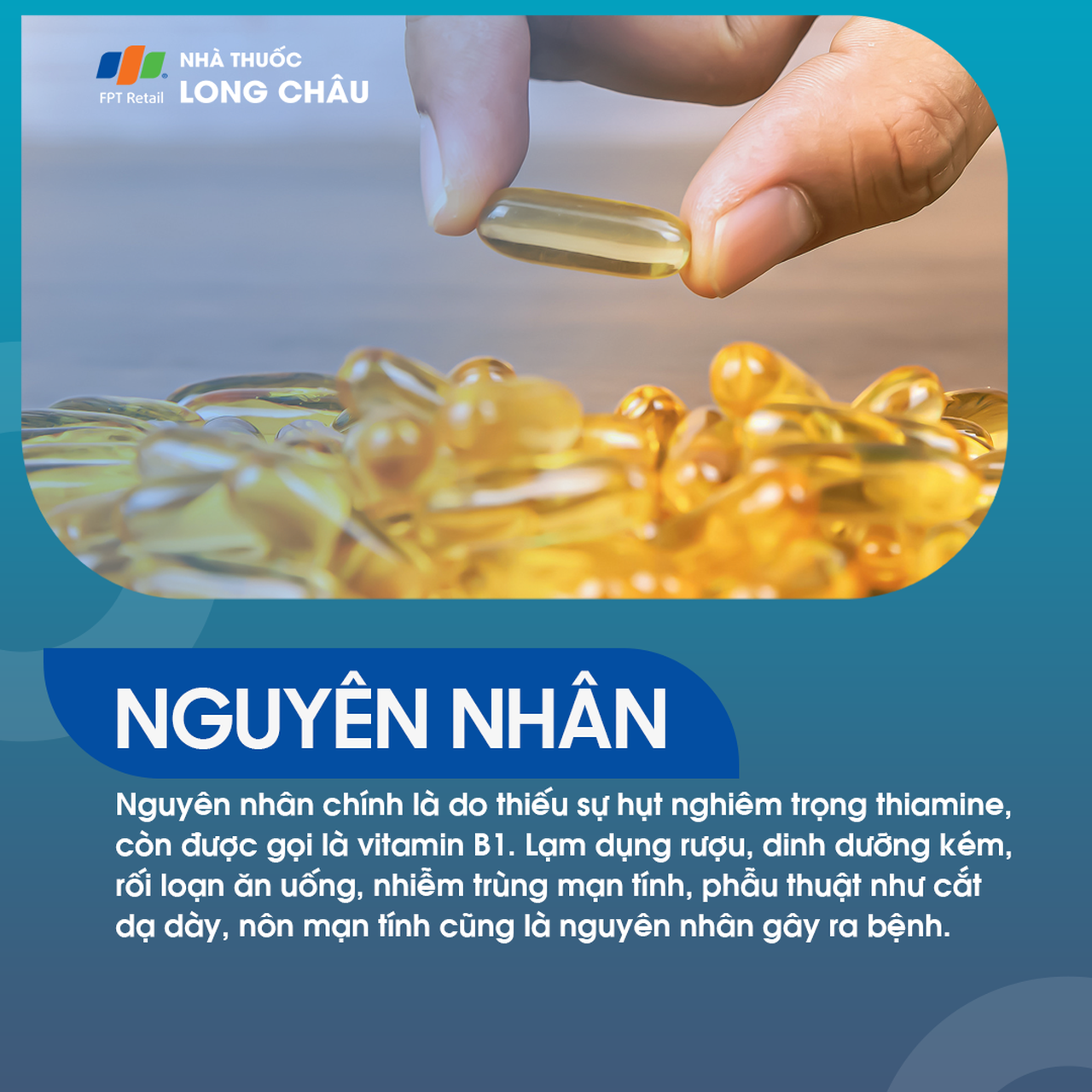 Hội chứng mất trí nhớ Korsakoff 3