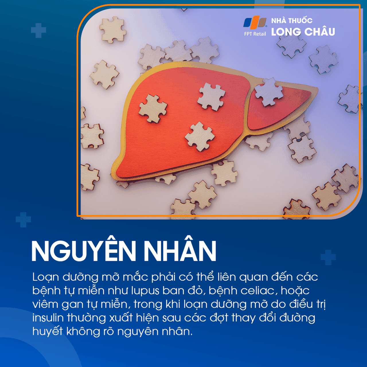 Loạn dưỡng mỡ 4