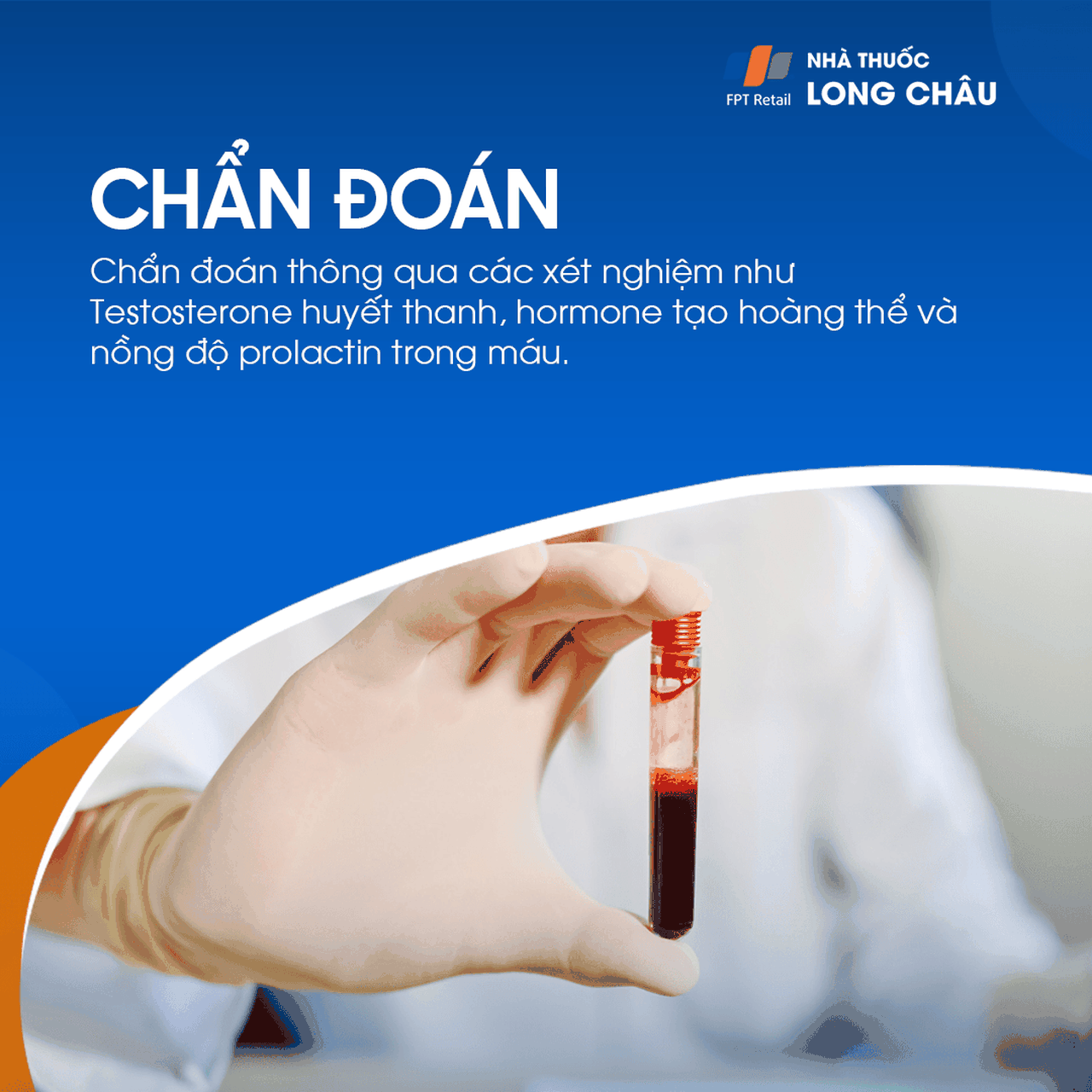 Suy giảm testosterone 7