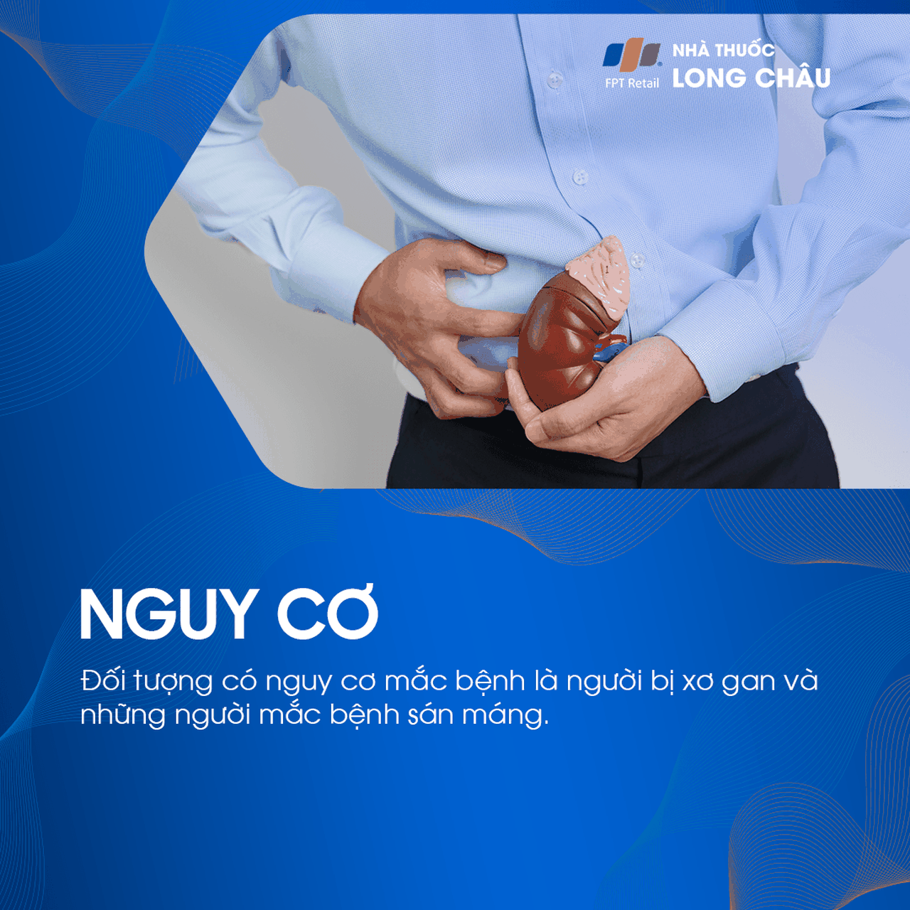 Tăng áp tĩnh mạch cửa 4