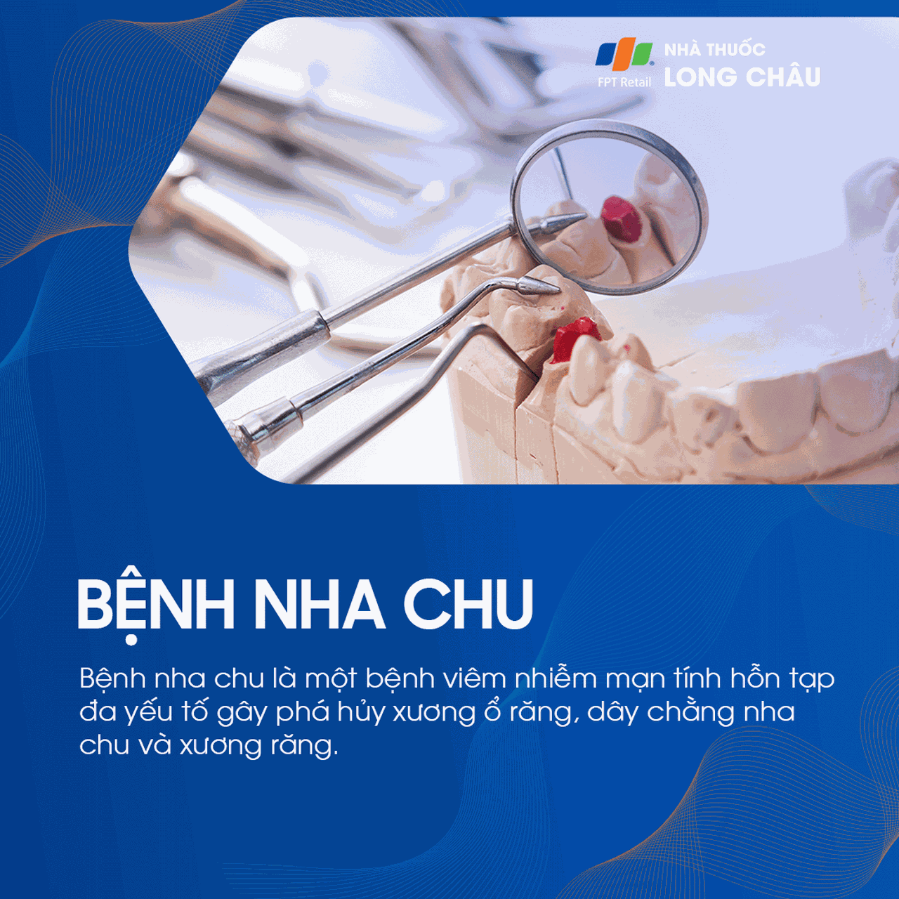 Bệnh nướu và nha chu 1