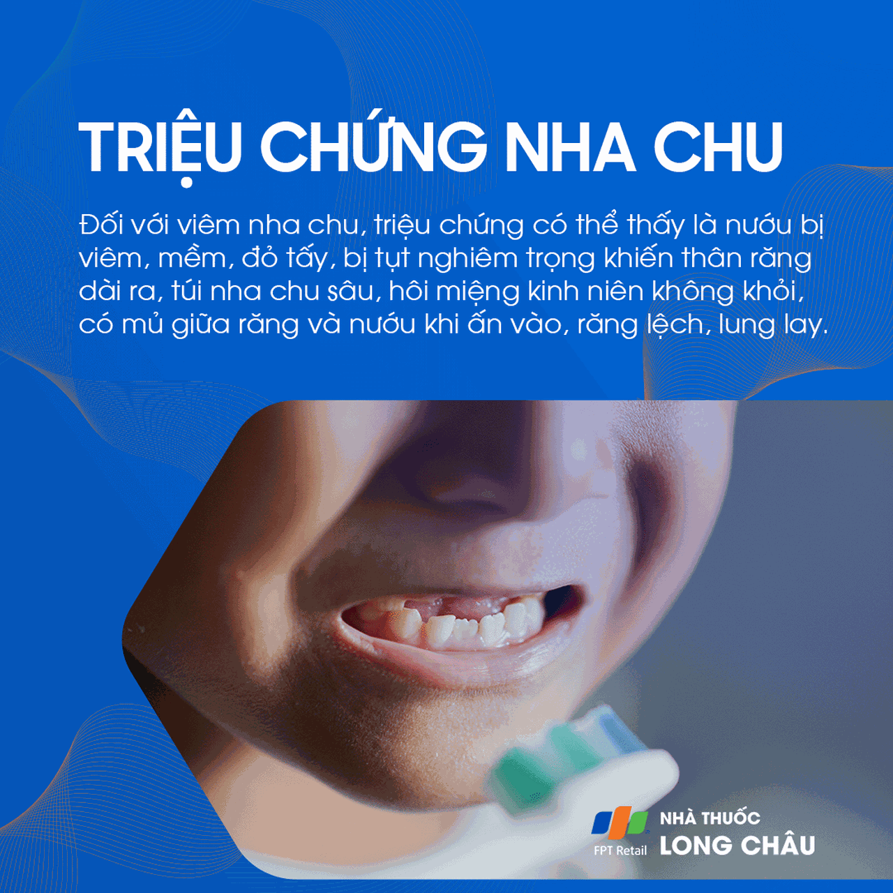 Bệnh nướu và nha chu 3