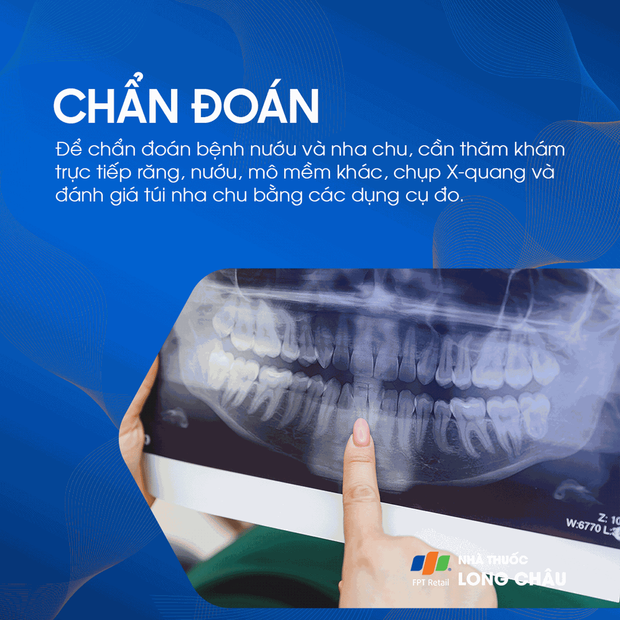 Bệnh nướu và nha chu 7