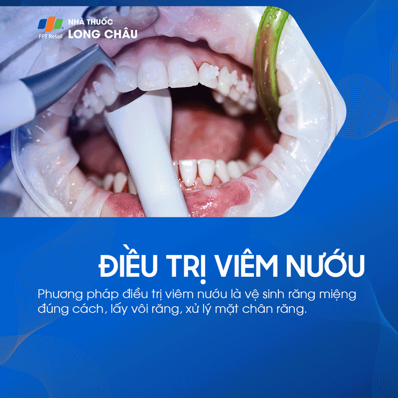 Bệnh nướu và nha chu 9