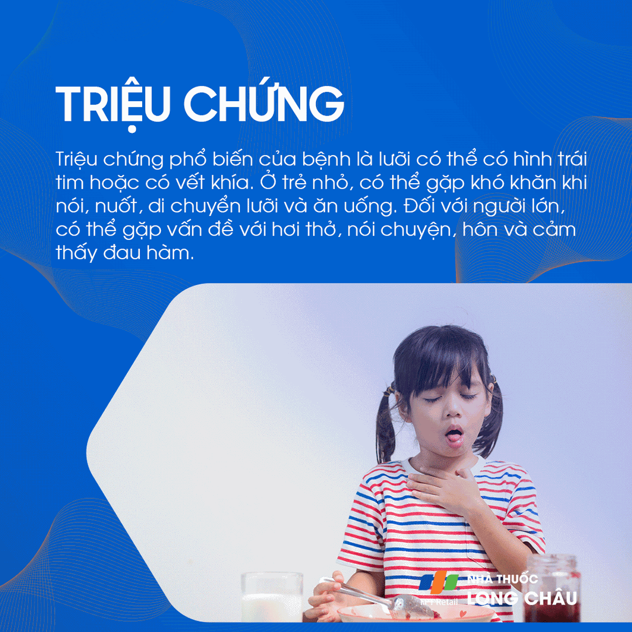 Dính thắng lưỡi 2