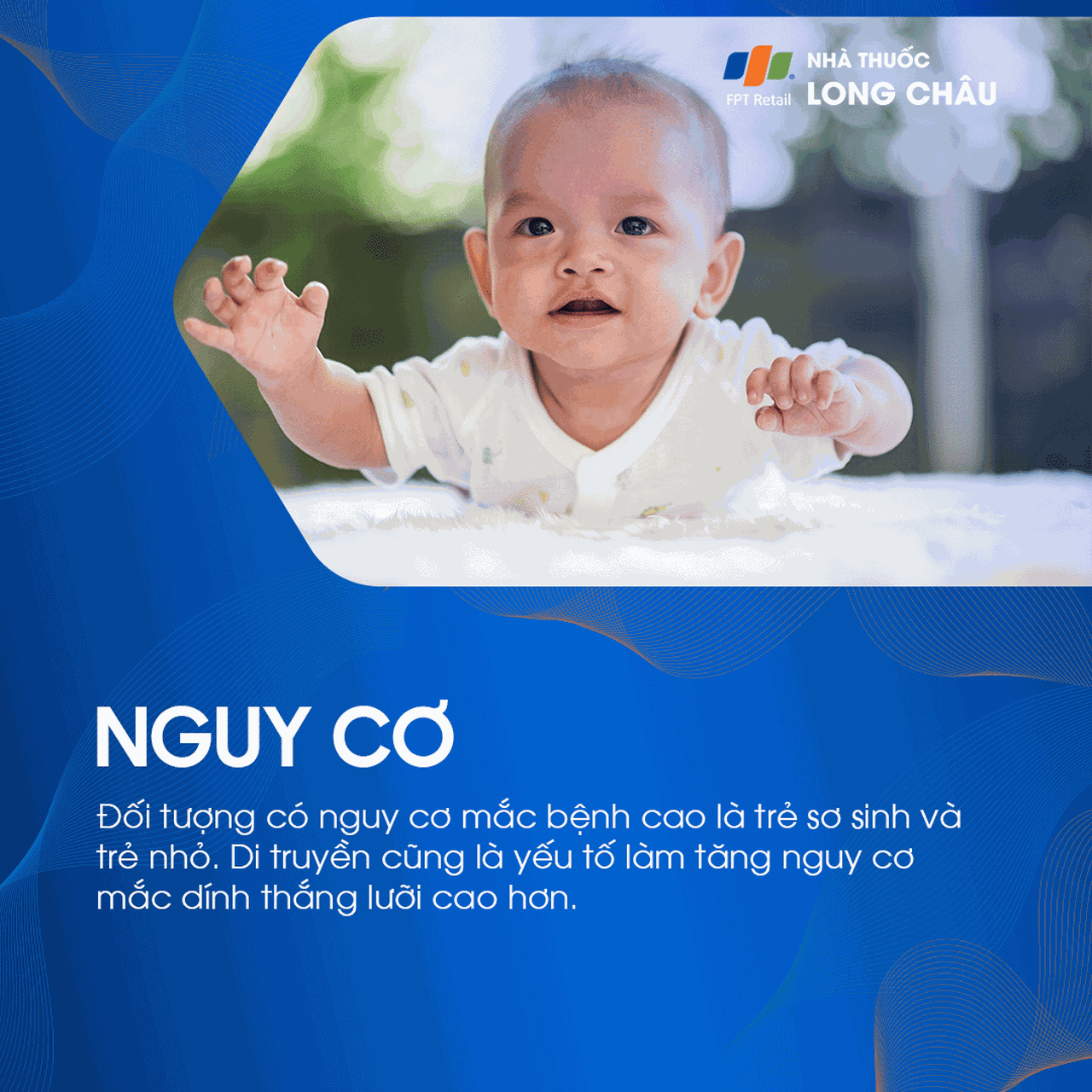 Dính thắng lưỡi 4