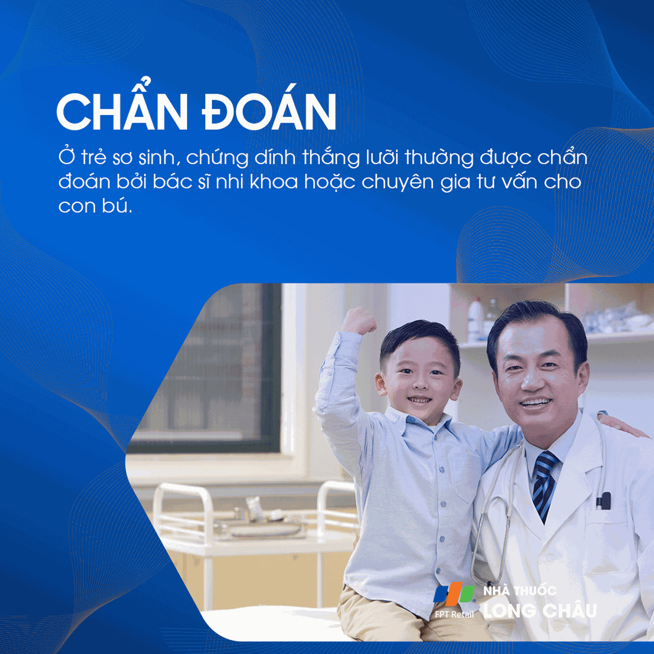 Dính thắng lưỡi 5