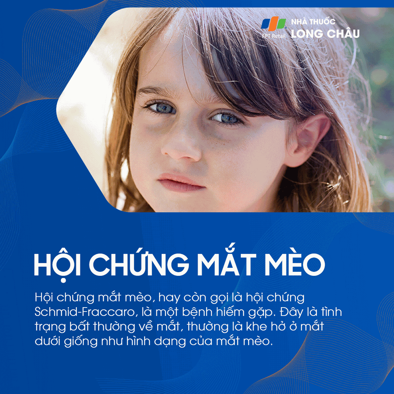 Hội chứng mắt mèo 1