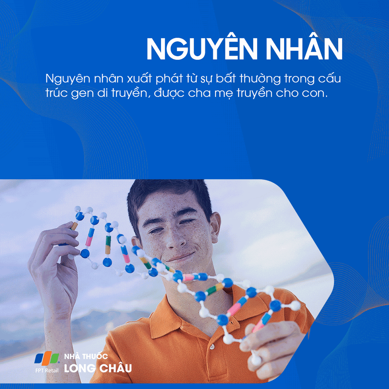 Hội chứng mắt mèo 3