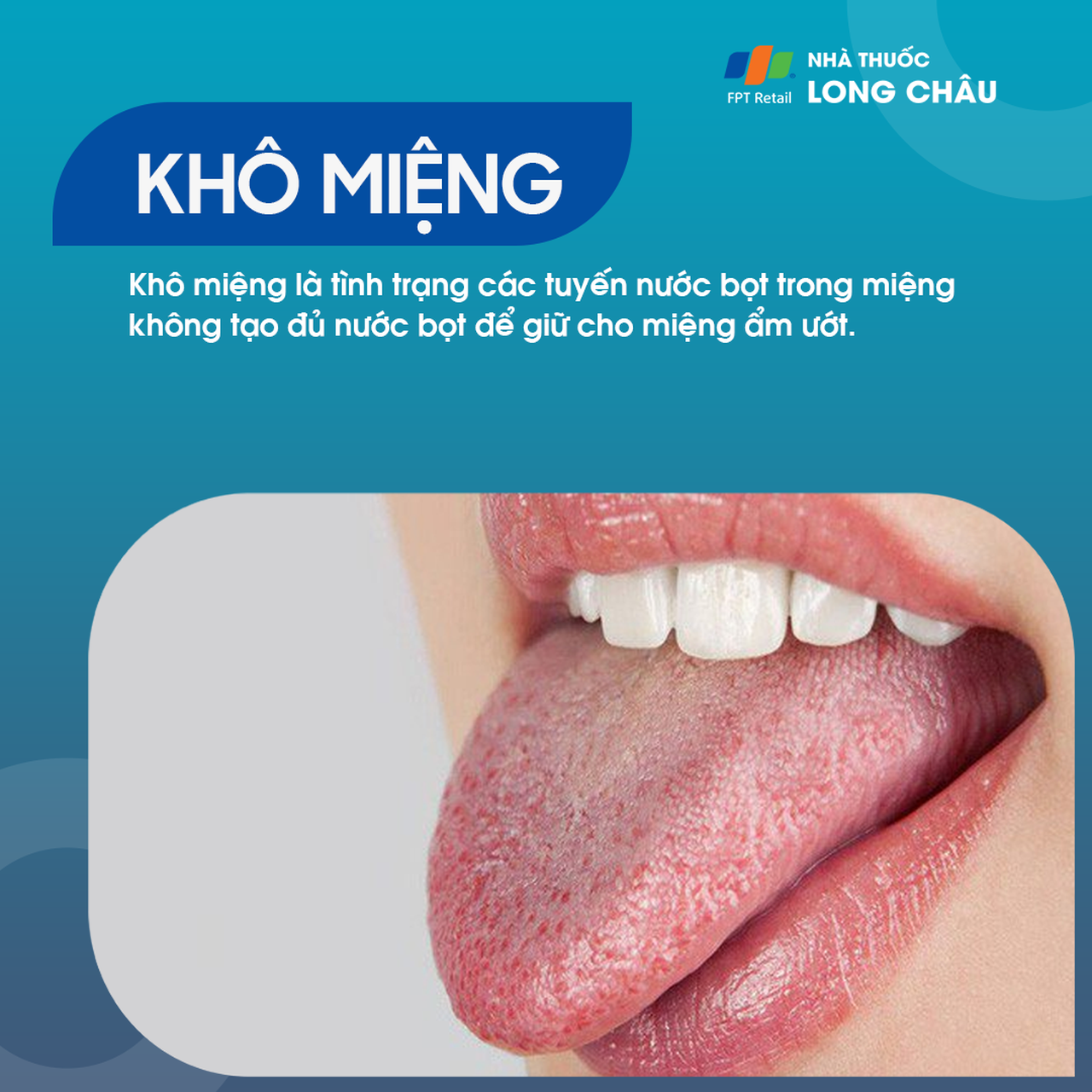 Khô miệng 1