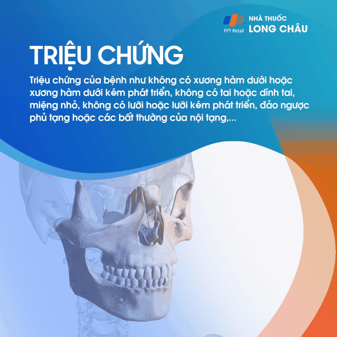 Tật không có hàm 2