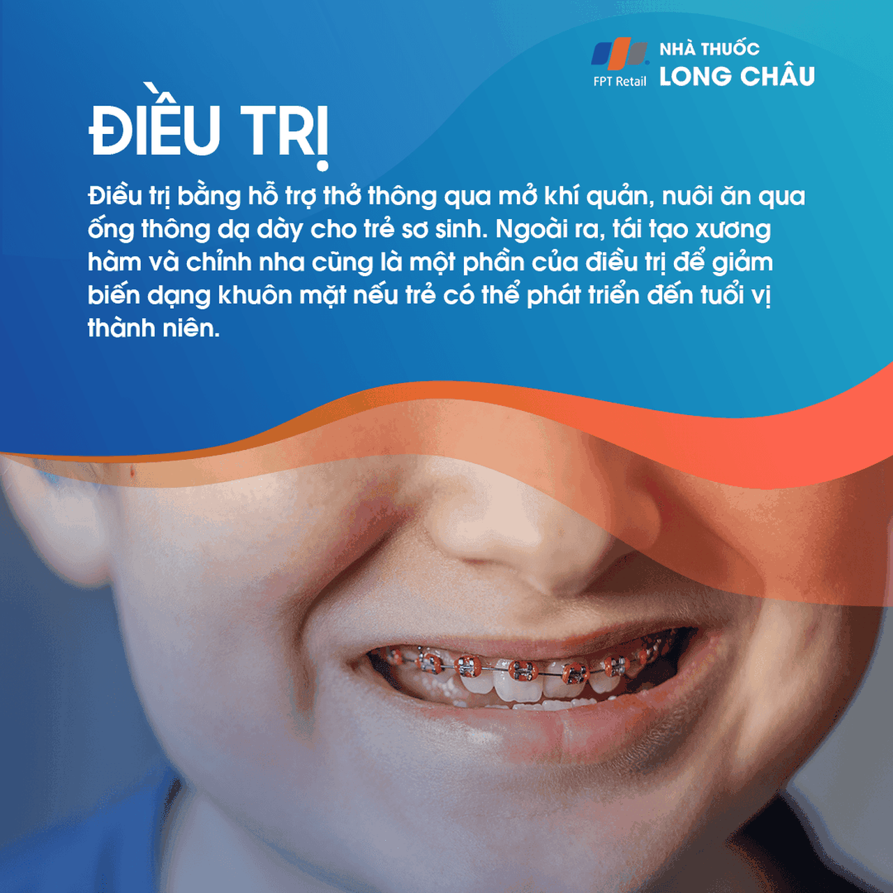 Tật không có hàm 6