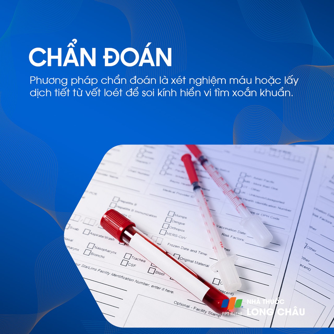 Chẩn đoán bệnh giang mai qua xét nghiệm máu hoặc soi kính hiển vi