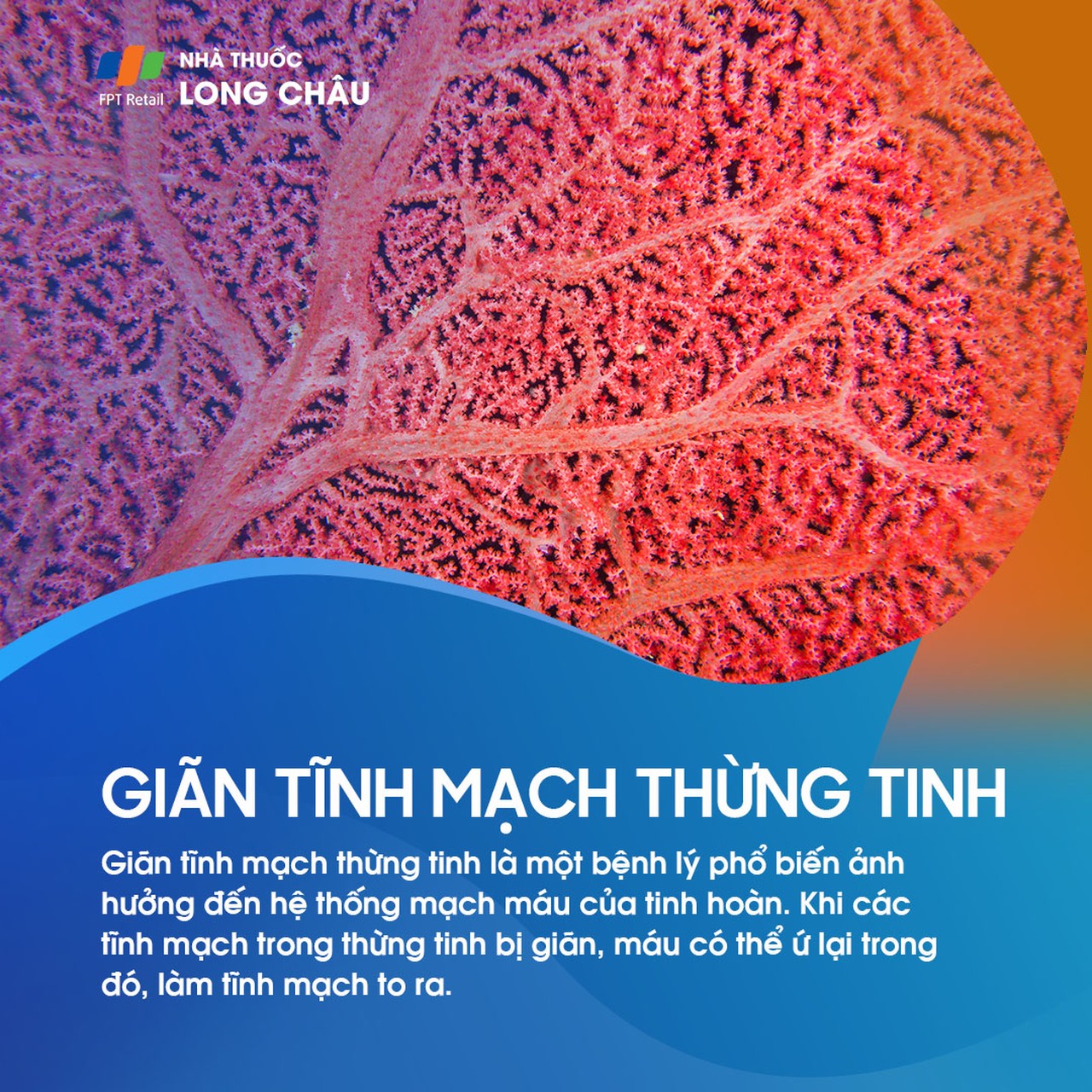 Giãn tĩnh mạch thừng tinh 1