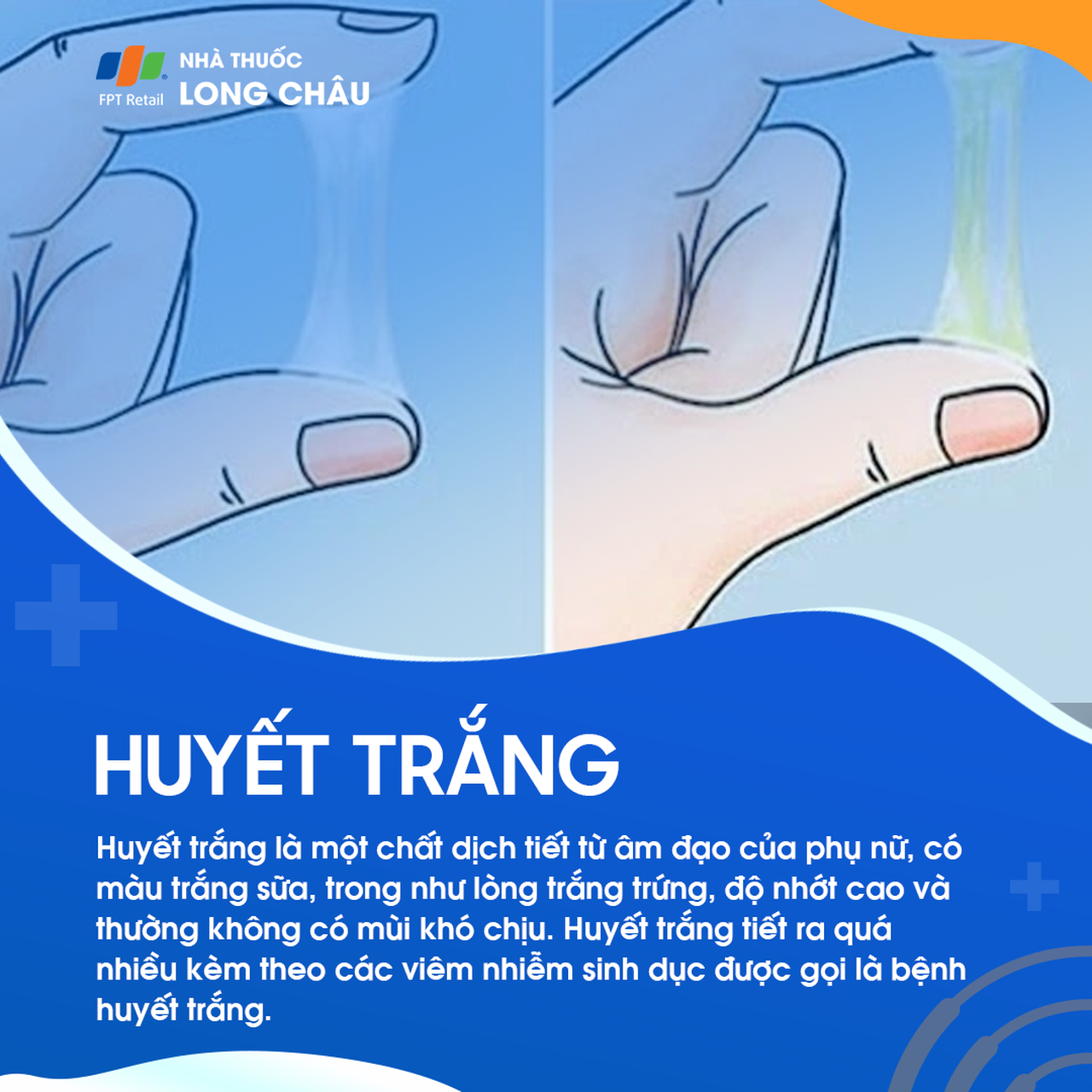 Huyết trắng 1