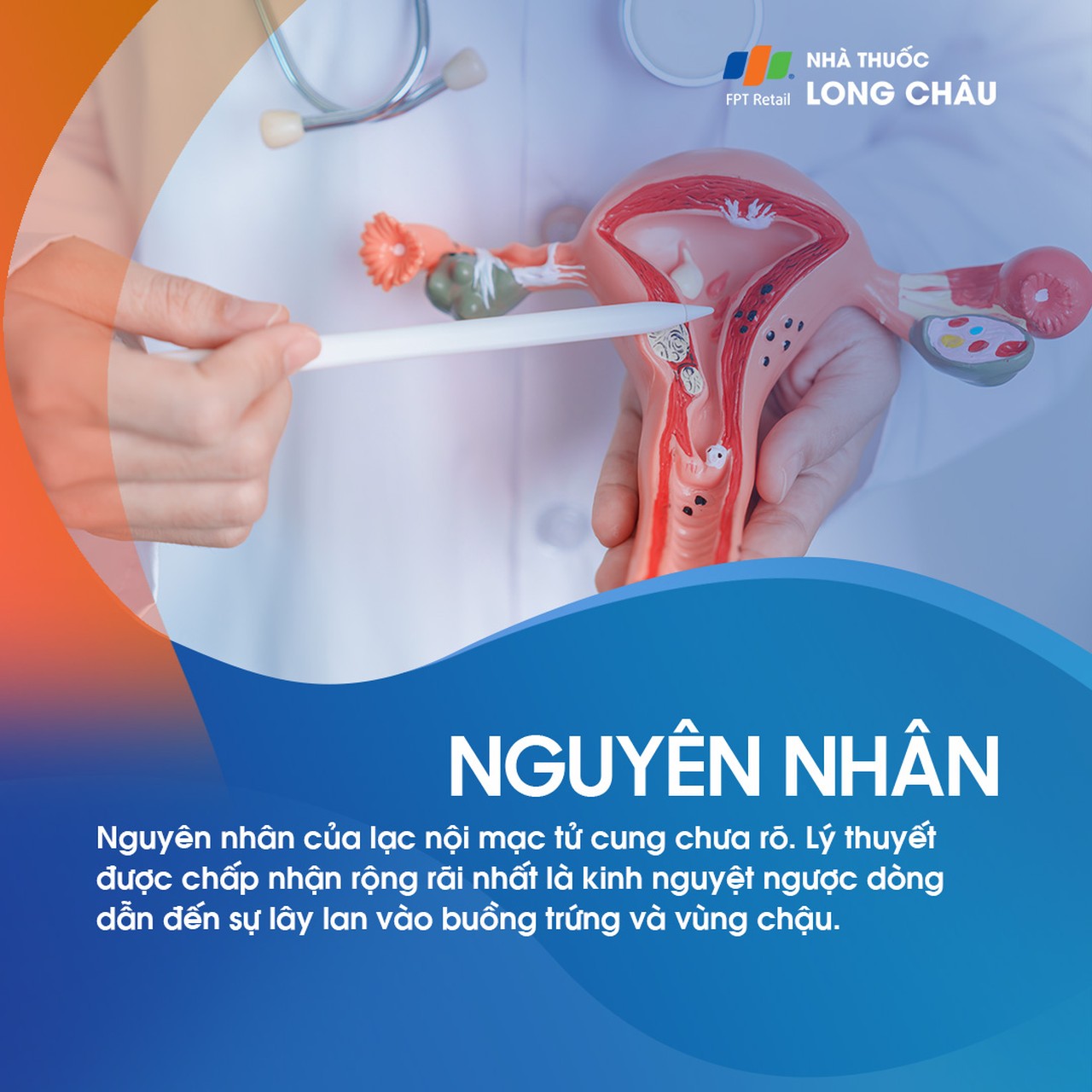 Lạc nội mạc ở âm hộ 3