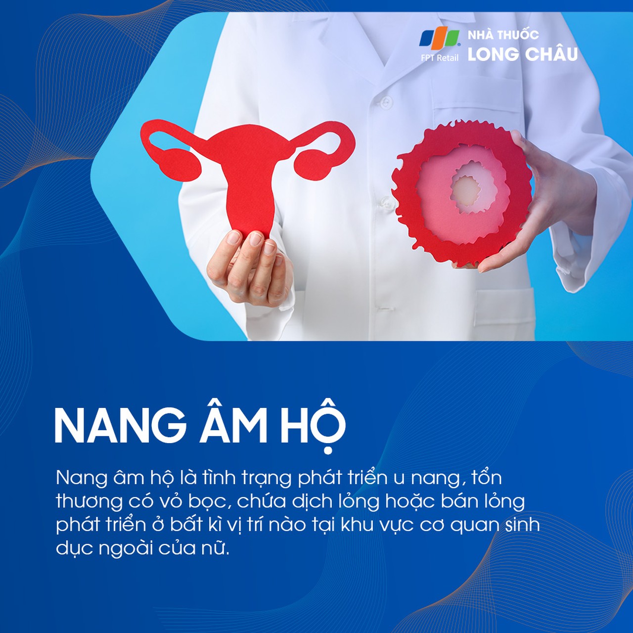 Nang âm hộ 1