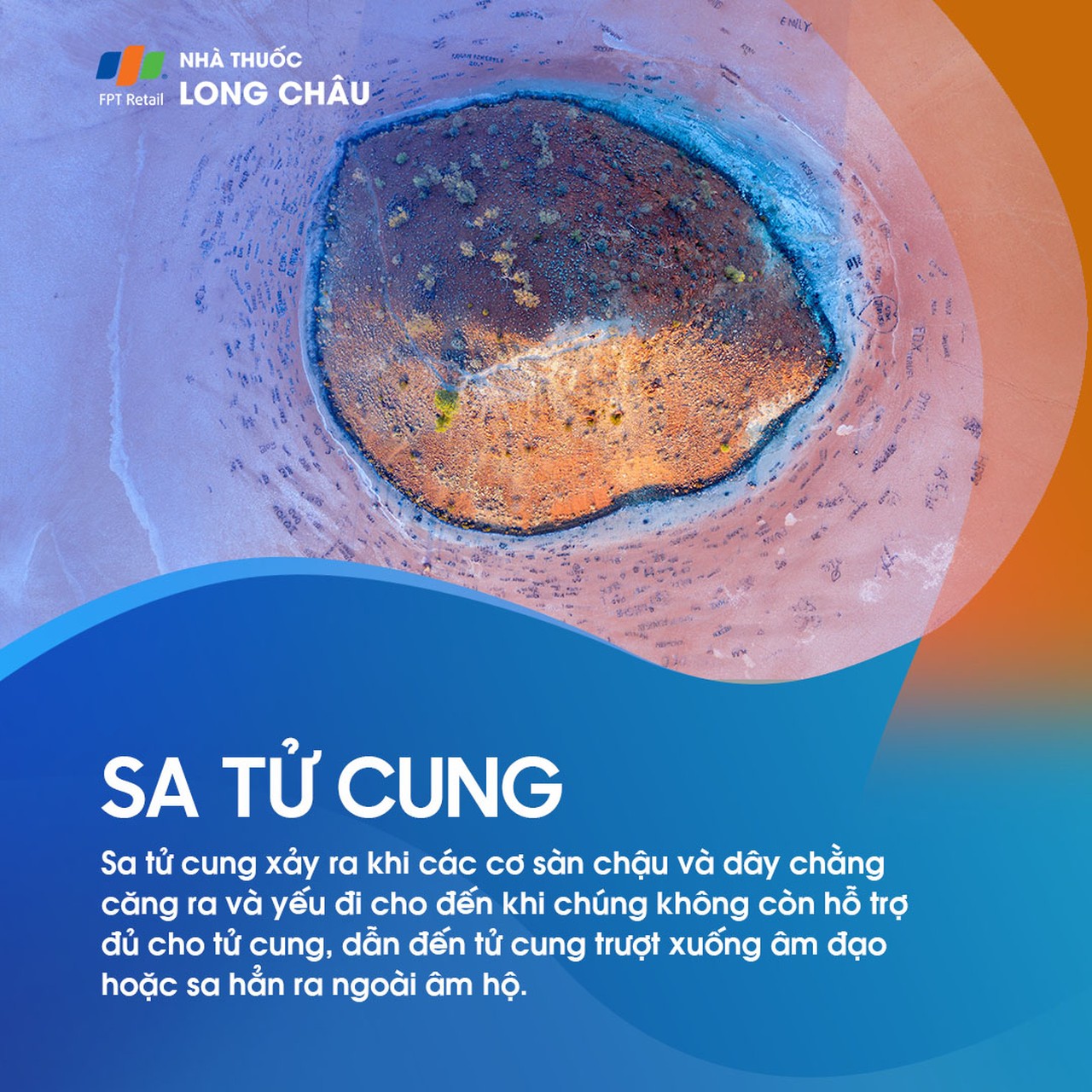 Sa tử cung 1