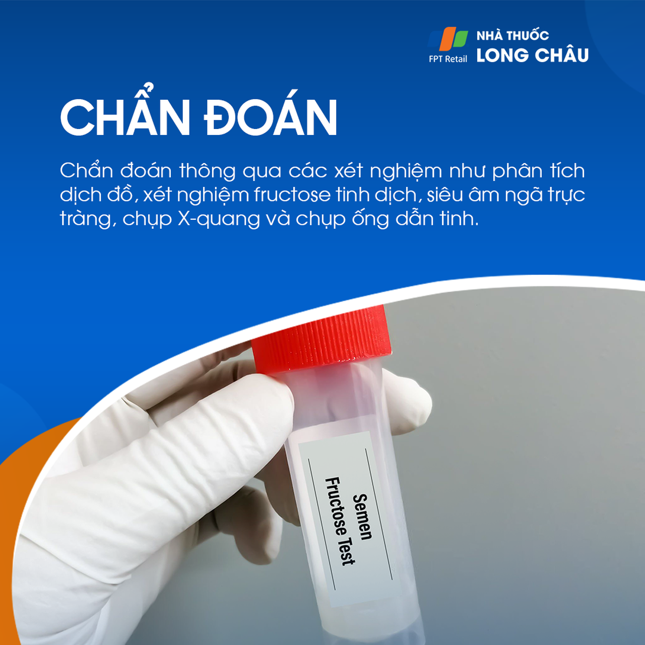 tắc ống dẫn tinh 5